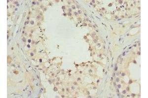 Immunohistochemistry of paraffin-embedded human testis tissue using ABIN7174649 at dilution of 1:100 (UGT3A2 Antikörper  (AA 23-300))