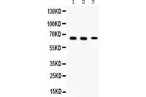 Western blot analysis of Alpha Internexin expression in rat brain extract ( Lane 1), mouse brain extract ( Lane 2) and 22RV1 whole cell lysates ( Lane 3).
