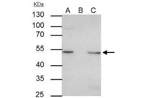 IP Image ILK antibody [N1C1] immunoprecipitates ILK protein in IP experiments. (ILK Antikörper)