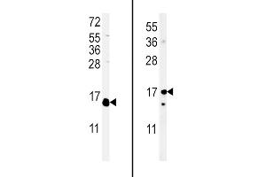 (LEFT)Western blot analysis of IL4 Antibody (C-term) (ABIN651434 and ABIN2840238) in WiDr cell line lysates (35 μg/lane). (IL-4 Antikörper  (C-Term))