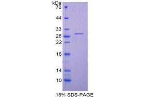 SDS-PAGE (SDS) image for Cardiac Troponin I (TNNI3) (AA 1-203) protein (His tag) (ABIN1099556)