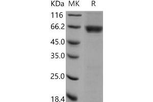 Western Blotting (WB) image for Casein Kinase 2 alpha 1 (CSNK2A1) (Active) protein (GST tag) (ABIN7317101) (CSNK2A1/CK II alpha Protein (GST tag))