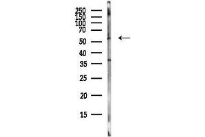 Western blot analysis of lysates from Rat lung, using Phospho-MLKL (Ser360) Antibody at 1/1000 dilution.