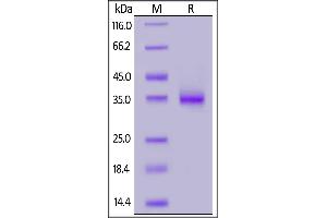 SARS-CoV-2 S protein RBD (N501Y), His Tag on  under reducing (R) condition. (SARS-CoV-2 Spike Protein (N501Y, RBD) (His tag))