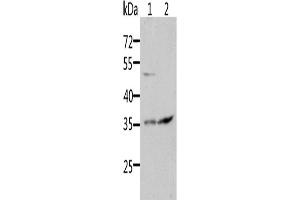 Western Blotting (WB) image for anti-Suppressor of Cytokine Signaling 1 (SOCS1) antibody (ABIN2431838) (SOCS1 Antikörper)