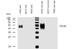 Western blotting analysis of human CD142 using mouse monoclonal antibody HTF-1 on lysates of A431 cell line and MCF7 and THP1 cell lines (negative controls) under reducing and non-reducing conditions. (Tissue factor Antikörper)