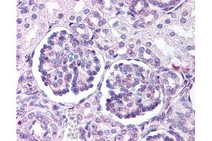 Immunohistochemistry (IHC) image for anti-Wingless-Type MMTV Integration Site Family, Member 9B (WNT9B) (Internal Region) antibody (ABIN1049489)