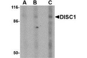 Western blot analysis of DISC1 in SK-N-SH cell lysate with AP30292PU-N DISC1 antibody at (A) 0. (DISC1 Antikörper  (Center))