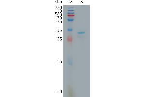 SDS-PAGE (SDS) image for Fibrinogen-Like 1 (FGL1) (AA 23-312) protein (His tag) (ABIN7491253)