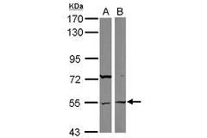 Image no. 1 for anti-Ankyrin Repeat and SOCS Box-Containing 3 (ASB3) (AA 197-433) antibody (ABIN1496739) (ASB3 Antikörper  (AA 197-433))