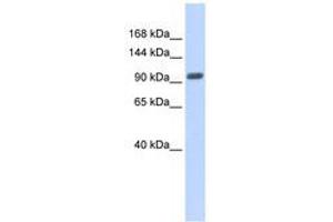 Image no. 1 for anti-Zinc Finger Protein 512B (ZNF512B) (AA 539-588) antibody (ABIN6740330) (ZNF512B Antikörper  (AA 539-588))