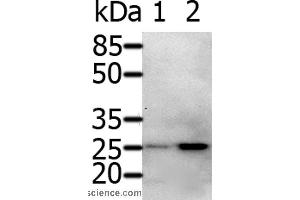 Western blot analysis of 231 cell and Human fetal brain tissue, using RAB5A Polyclonal Antibody at dilution of 1:600 (RAB5 Antikörper)