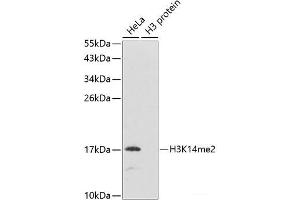 Western blot analysis of extracts of various cell lines using DiMethyl-Histone H3-K14 Polyclonal Antibody. (Histone 3 Antikörper  (2meLys14))