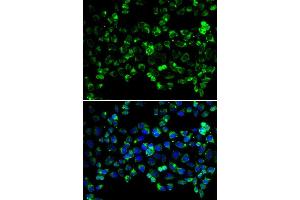 Immunofluorescence analysis of HeLa cells using PINK1 antibody (ABIN5998524). (PINK1 Antikörper)