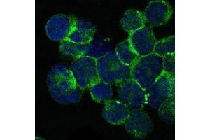 Immunofluorescence analysis of Jurkat cells using ITK mouse mAb (green). (ITK Antikörper)