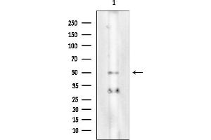 anti-Pyroglutamylated RFamide Peptide Receptor (QRFPR) (Internal Region) antibody