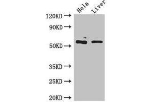 Western Blot Positive WB detected in: Hela whole cell lysate, Mouse liver tissue All lanes: KRT81 antibody at 5 μg/mL Secondary Goat polyclonal to rabbit IgG at 1/50000 dilution Predicted band size: 55 kDa Observed band size: 55 kDa