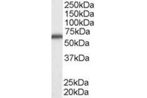 Western Blotting (WB) image for anti-DEAD (Asp-Glu-Ala-Asp) Box Polypeptide 5 (DDX5) (C-Term) antibody (ABIN2465593) (DDX5 Antikörper  (C-Term))