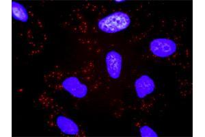 Proximity Ligation Analysis of protein-protein interactions between CACYBP and TBL1X. (CACYBP Antikörper  (AA 1-228))