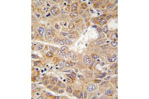 Immunohistochemistry (IHC) image for anti-Phosphoglycerate Kinase 1 (PGK1) (AA 117-145) antibody (ABIN5531821)