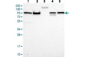 Western blot analysis of Lane 1: RT-4, Lane 2: U-251 MG, Lane 3: Human Plasma, Lane 4: Liver, Lane 5: Tonsil with FCHSD2 polyclonal antibody  at 1:250-1:500 dilution. (FCHSD2 Antikörper)