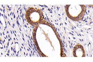 Immunohistochemistry (IHC) image for anti-Keratin 7 (KRT7) (AA 91-394) antibody (ABIN7432025)