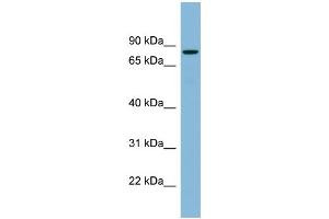 WB Suggested Anti-EPB41 Antibody Titration:  0. (EPB41 Antikörper  (N-Term))