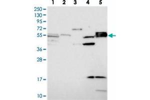 Western blot analysis of Lane 1: RT-4, Lane 2: U-251 MG, Lane 3: Human Plasma, Lane 4: Liver, Lane 5: Tonsil with SRFBP1 polyclonal antibody  at 1:250-1:500 dilution.