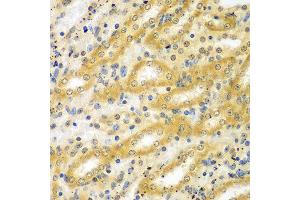 Immunohistochemistry of paraffin-embedded mouse kidney using ADCK3 antibody at dilution of 1:100 (x40 lens). (COQ8A Antikörper)