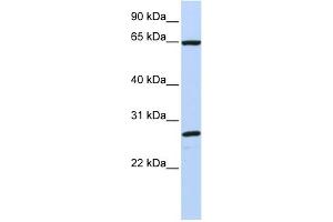WB Suggested Anti-DNAJC1 Antibody Titration:  0. (DNAJC1 Antikörper  (C-Term))