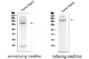 Western blot analysis of ADAMTS13 using anti-ADAMTS13 antibody (ABIN4886425).