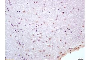 Formalin-fixed and paraffin embedded rat brain labeled with Anti-HSP70/HSPA1A Polyclonal Antibody, Unconjugated (ABIN1387822) at 1:200 followed by conjugation to the secondary antibody and DAB staining (HSP70 1A/ 1B (AA 500-600) Antikörper)