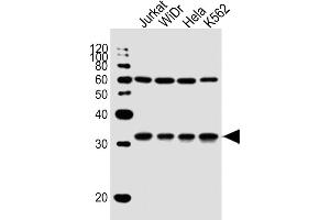 All lanes : Anti-EXOSC6 Antibody (N-term) at 1:1000 dilution Lane 1: Jurkat whole cell lysate Lane 2: WiDr whole cell lysate Lane 3: Hela whole cell lysate Lane 4: K562 whole cell lysate Lysates/proteins at 20 μg per lane. (EXOSC6 Antikörper  (N-Term))