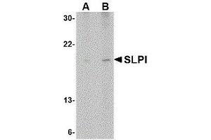 Western Blotting (WB) image for anti-Secretory Leukocyte Peptidase Inhibitor (SLPI) (Center) antibody (ABIN2476522) (SLPI Antikörper  (Center))