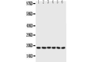 Anti-PLN antibody, Western blottingAll lanes: Anti PLN  at 0. (Phospholamban Antikörper  (N-Term))