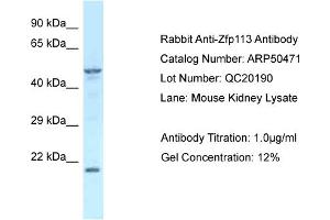 WB Suggested Anti-Zfp113 Antibody   Titration: 1. (Zfp113 Antikörper  (Middle Region))