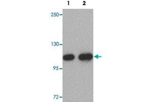 Western blot analysis of mouse liver tissue with CDC27 polyclonal antibody  at (Lane 1) 1 and (Lane 2) 2 ug/mL dilution. (CDC27 Antikörper  (C-Term))