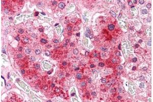 Human Adrenal: Formalin-Fixed, Paraffin-Embedded (FFPE) (COMT Antikörper  (N-Term))