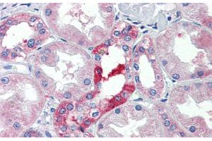 Immunohistochemistry with Human kidney lysate tissue at an antibody concentration of 5. (SLC25A28 Antikörper  (C-Term))