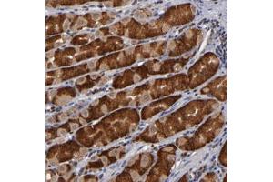 Immunohistochemical staining of human stomach with ALG13 polyclonal antibody  shows strong cytoplasmic positivity in glandular cells.
