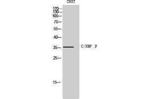 Western Blotting (WB) image for anti-CCAAT/enhancer Binding Protein (C/EBP), beta (CEBPB) (Ser243) antibody (ABIN3174087) (CEBPB Antikörper  (Ser243))