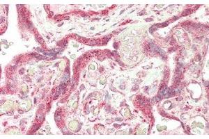 Detection of FUR in Human Placenta Tissue using Polyclonal Antibody to Furin (FUR) (FURIN Antikörper  (AA 385-500))