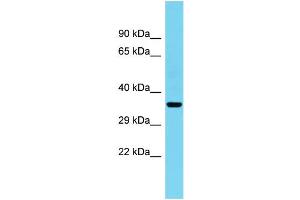 Host: Rabbit Target Name: C1orf222 Sample Type: Fetal Heart lysates Antibody Dilution: 1. (CFAP74/KIAA1751 Antikörper  (C-Term))