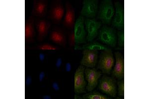 ABIN6263071 and ABIN6266879 staining  cells by IF/ICC. (Melanoma Antigen Family D, 4 (MAGED4) (C-Term) Antikörper)