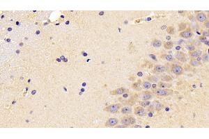 Immunohistochemistry (IHC) image for anti-serpin Peptidase Inhibitor, Clade F (Alpha-2 Antiplasmin, Pigment Epithelium Derived Factor), Member 1 (SERPINF1) (AA 20-418) antibody (ABIN7440725)