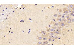 Detection of PEDF in Rat Cerebrum Tissue using Polyclonal Antibody to Pigment Epithelium Derived Factor (PEDF) (PEDF Antikörper  (AA 20-418))