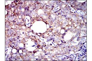 Image no. 3 for anti-Integrin beta 1 (ITGB1) antibody (ABIN1498894) (ITGB1 Antikörper)