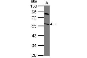 WB Image Sample (30 ug of whole cell lysate) A: K562 10% SDS PAGE antibody diluted at 1:1000 (SIRPG Antikörper)