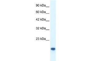 WB Suggested Anti-MYCBP Antibody Titration: 0. (MYCBP Antikörper  (Middle Region))