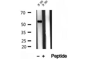 Western blot analysis of extracts of SW 1990 cells, using TMPRSS4 antibody.